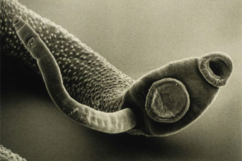 Токсоплазма