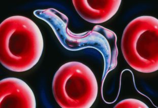 Особенности лечение и симптомы трипаносомоза