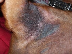 черный акантоз