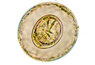 Фото: яйцо карликового цепня