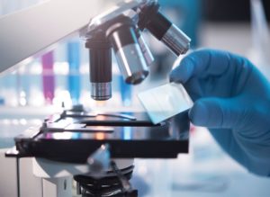 Если человек инфицирован, то цисты очень часто выявляются уже при первом лабораторном исследовании кала