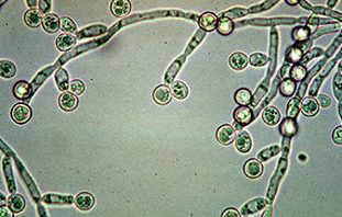 Candida albicans