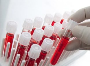 Анализ крови для диагностики гельминтов