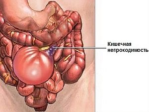 признаки кишечной непроходимости у собак