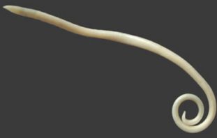 Что такое гельминтозы и каковы их симптомы?