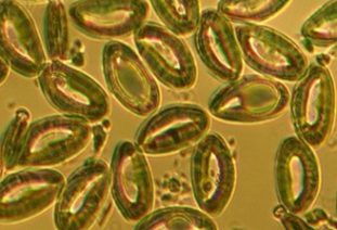 Яйца глистов под микроскопом