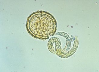 Личинка аскариды, освободившаяся от яйца