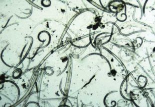 Капилляриоз: возбудители, симптомы, лечение и профилактика