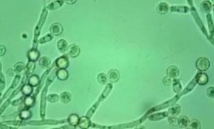 Грибы Candida
