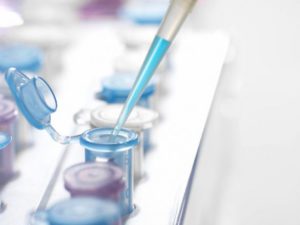 Контрольные лабораторные исследования – обязательный этап успешной терапии, контроля его динамики