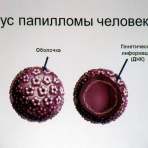 ВПЧ - вирус папилломы человека Какие средства предлагает медицина от вируса ВПЧ?