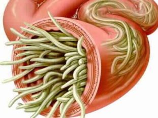 Какие глисты могут быть у человека?