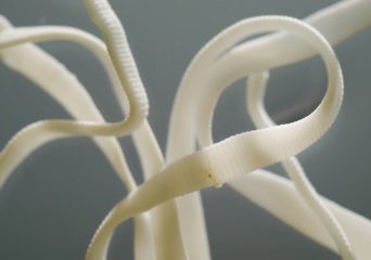 Причины, признаки, диагностика и лечение глистов у человека