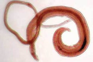 Фото: шистосома