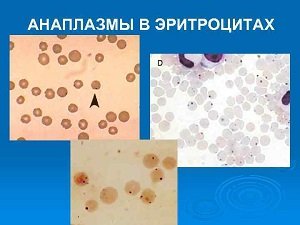анаплазмоз